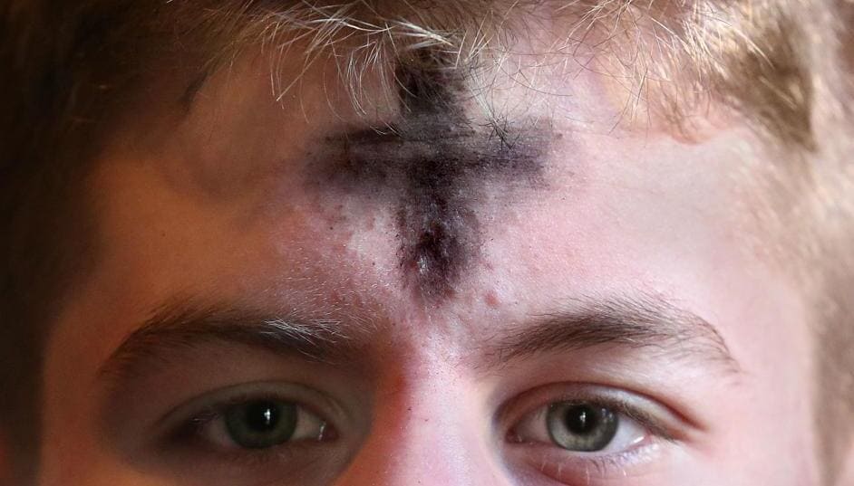 The Mark of The Beast Is The Cross
